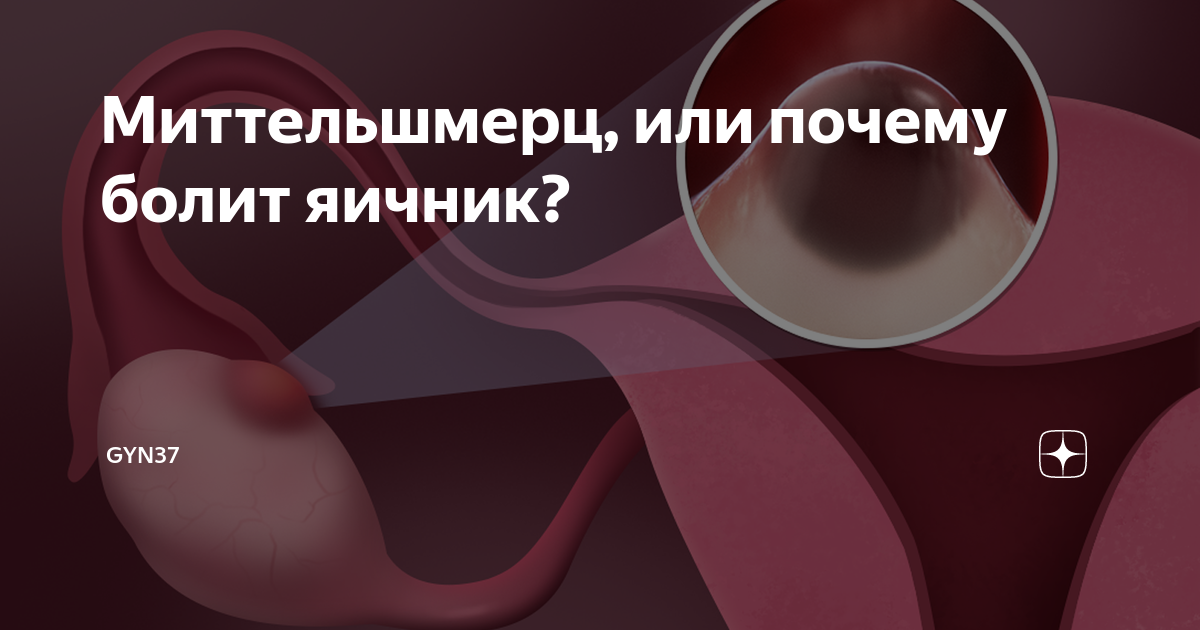 Миттельшмерц, или почему болит яичник? | GYN37 | Дзен