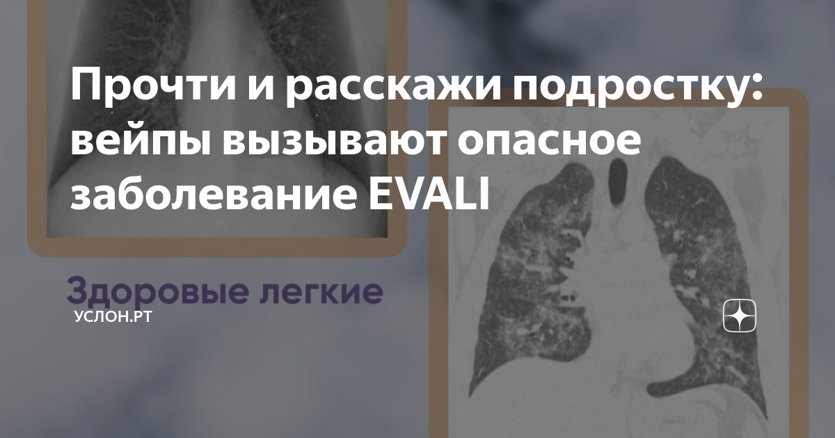 Новая болезнь evali