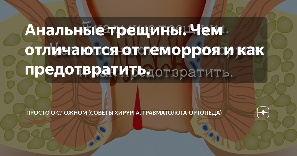 Трещина в заднем проходе форум. Трещина в заднем проходе симптомы. профилактика трещин заднего прохода. анальная трещина как лечить. трещина анального канала.