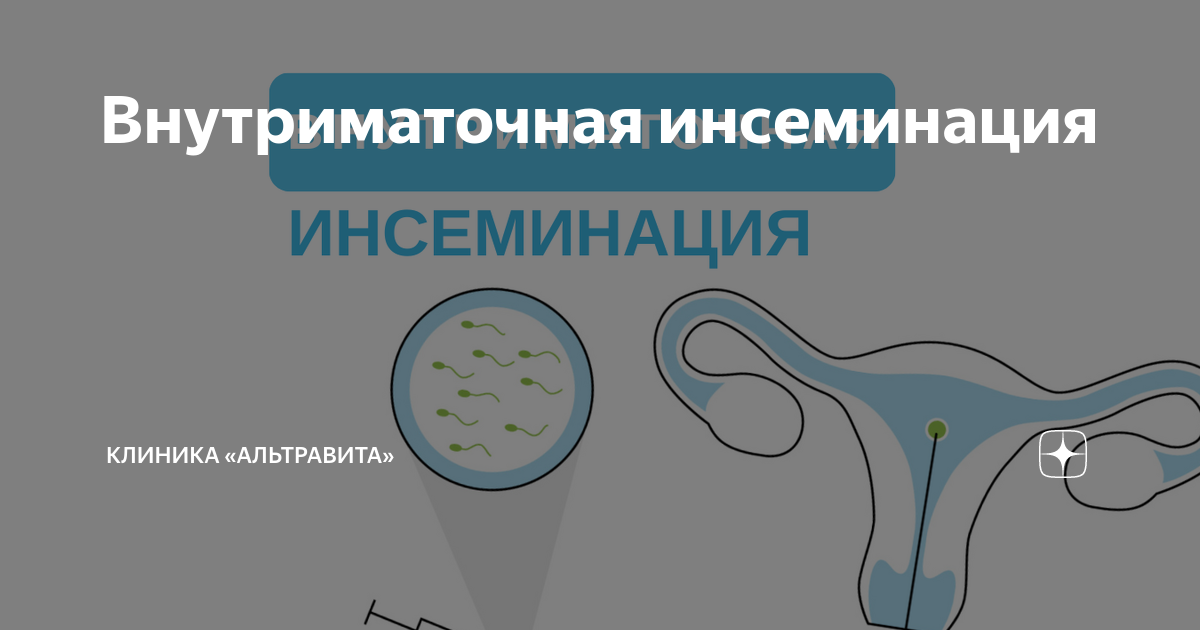 Внутриматочная искусственная инсеминация - цены | АРТ-ЭКО – клиника лечения бесплодия в Москве