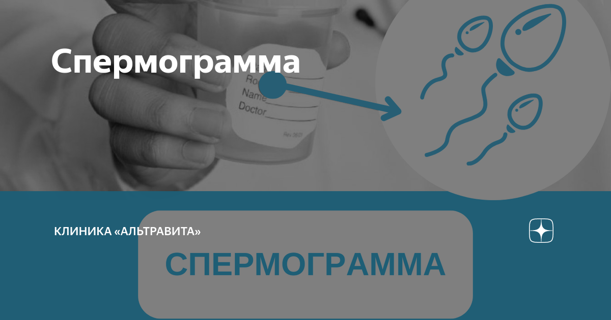 Показатели спермограммы: где можно сдать и как это сделать правильно