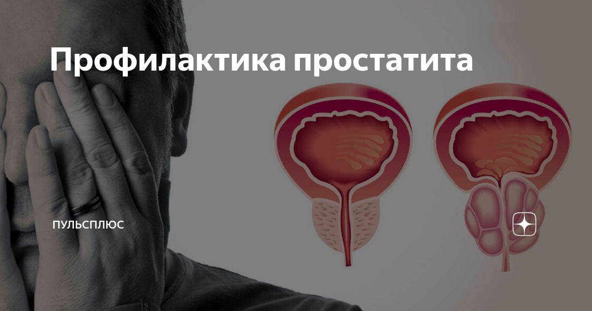 Профилактика простатита | ПульсПлюс | Дзен