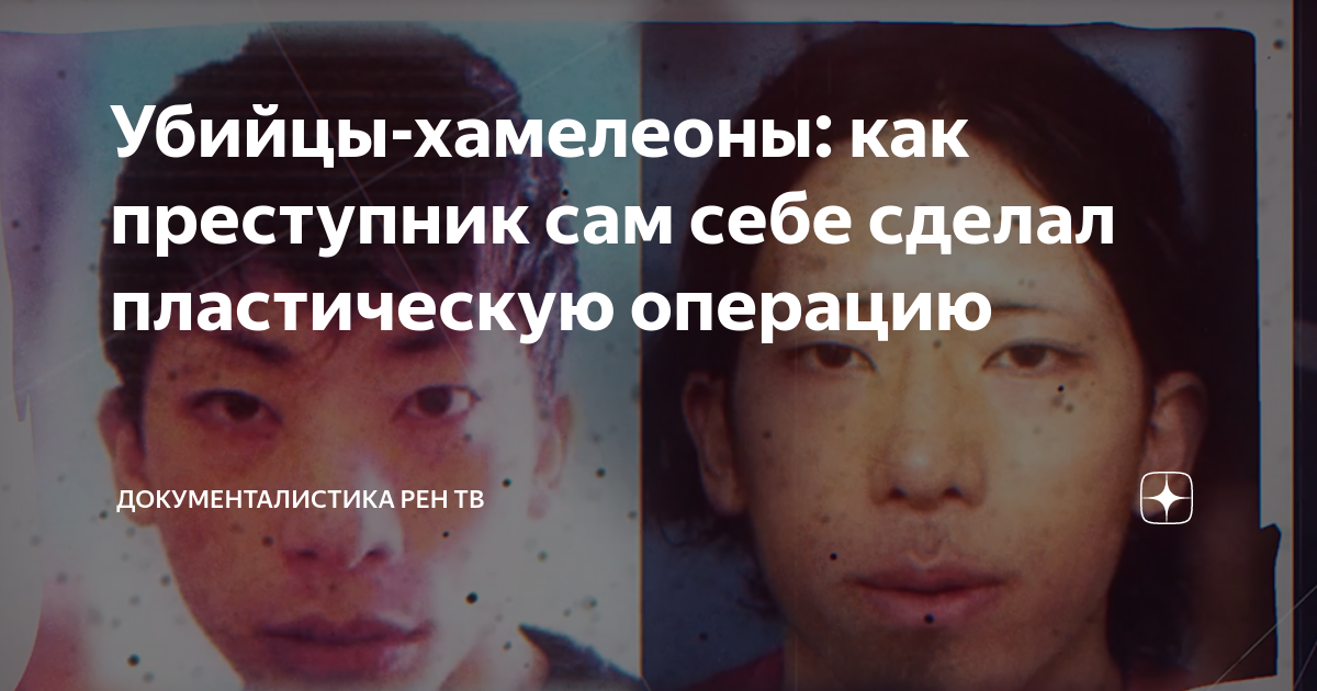 Убийцы-хамелеоны: как преступник сам себе сделал пластическую операцию ...