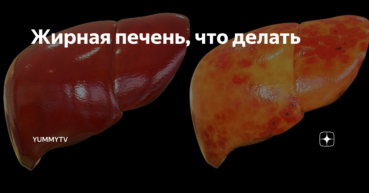 как печень связана с желудком