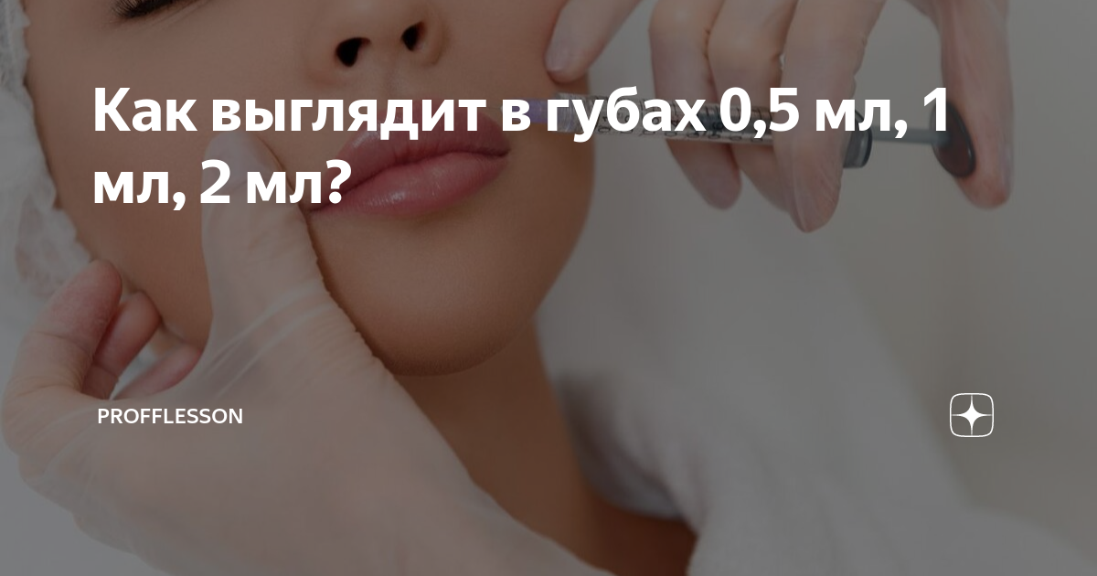 как выглядят губы после 0.5 мл