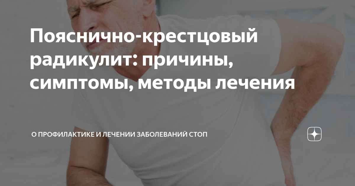 Радикулит причины лечение