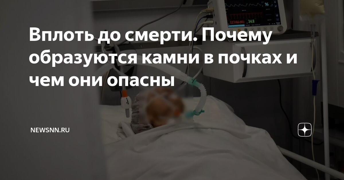 Вплоть до смерти. Почему образуются камни в почках и чем они опасны ...
