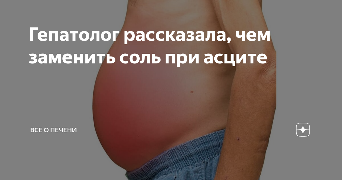 Гепатолог рассказала, чем заменить соль при асците | Все о печени | Дзен