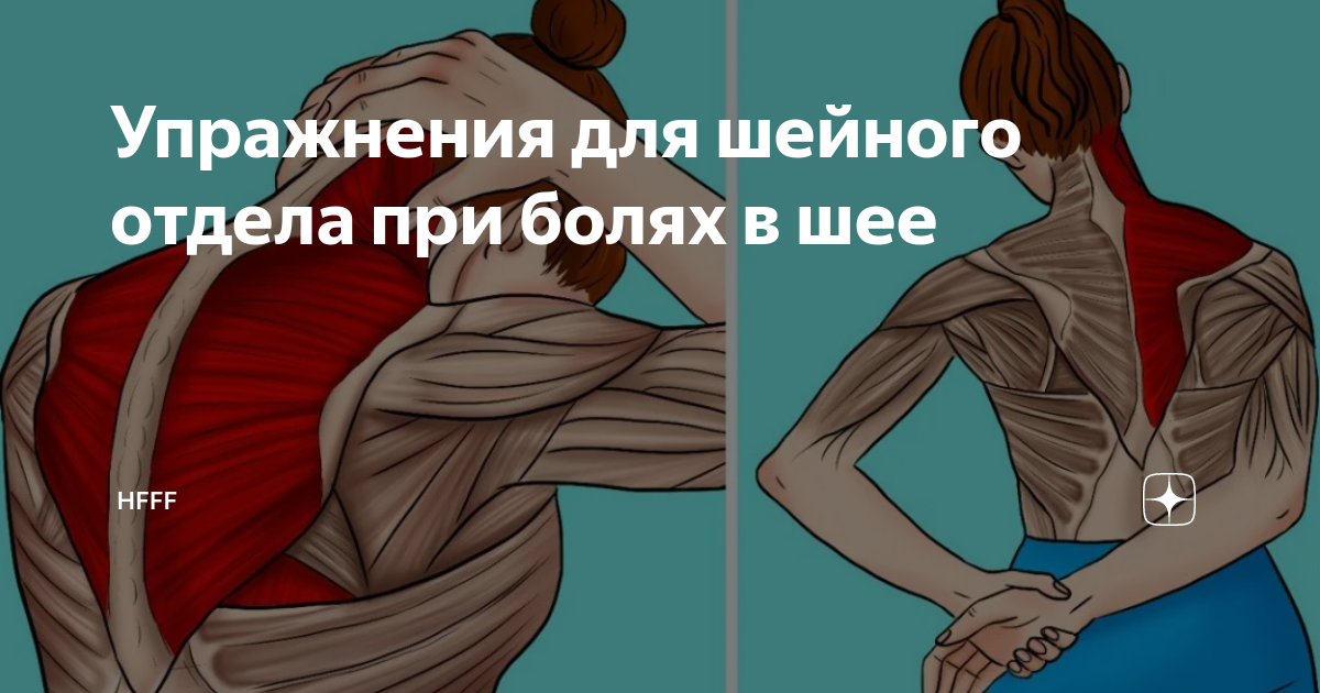 Упражнения для шейного отдела при болях в шее | Hfff | Дзен