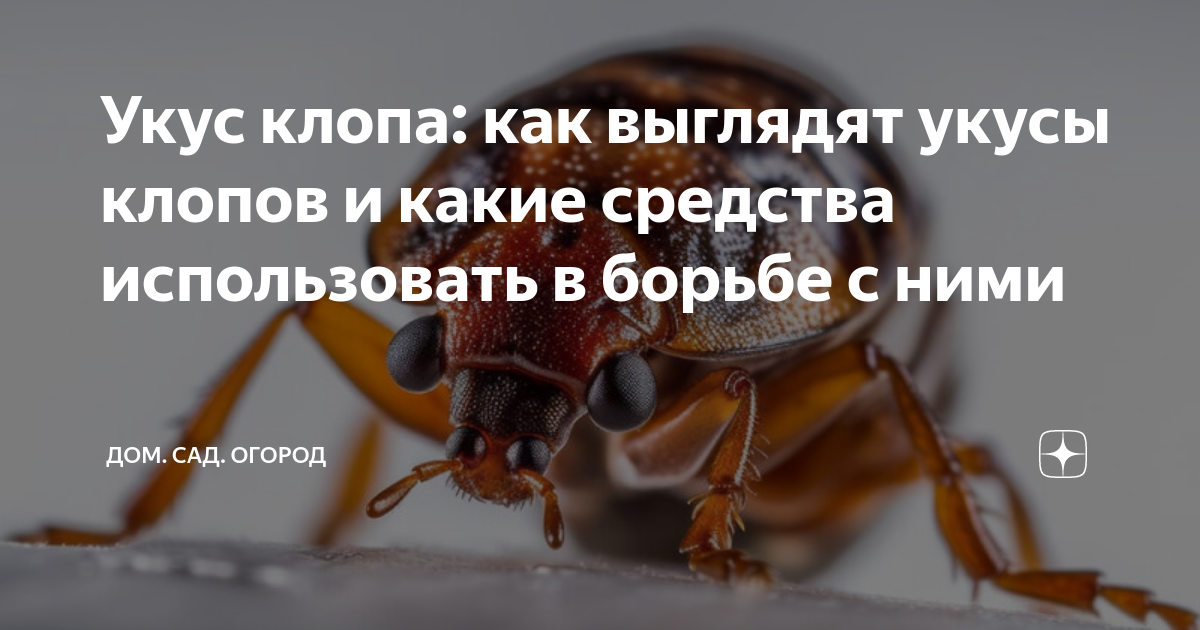 Укус клопа как выглядит форум Is Bed Bug Afraid Of Sunlight Bed Bugs Singapore Bed bugs, Bed bug control, B