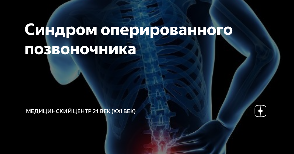 Синдром смежного уровня. Причина компрессии корешков спинного мозга. Лучевая диагностика синдрома оперированного позвоночника. Синдром оперированного позвоночника. Послеоперационный фиброз позвоночника.