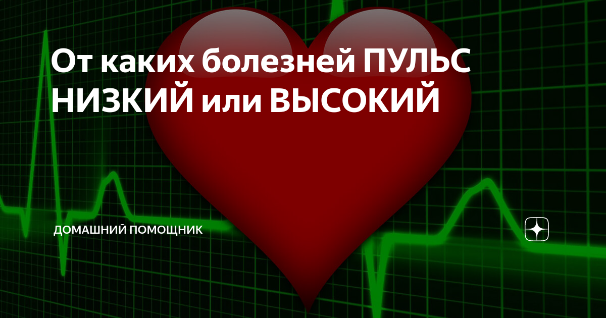 Учащенное сердцебиение (тахикардия): причины, что делать, лечение | Клиника Рассвет