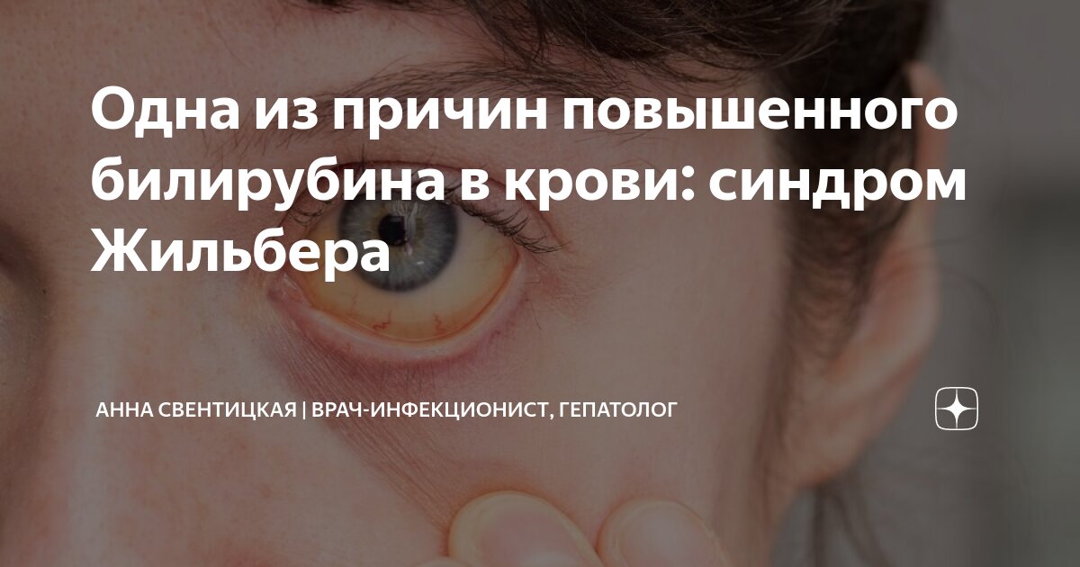Одна из причин повышенного билирубина в крови: синдром Жильбера | Анна ...