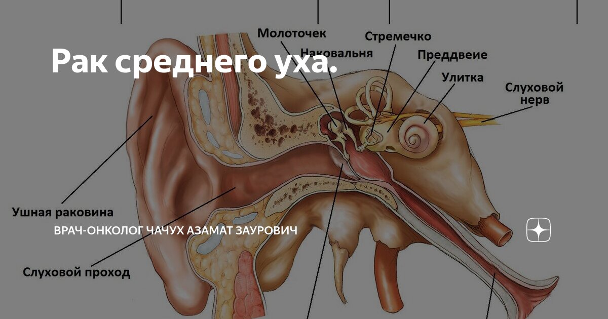 Рак на ухе у человека фото