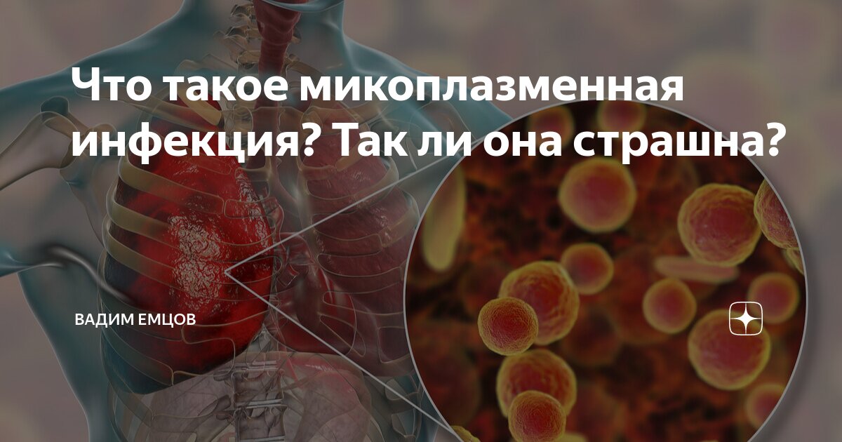 Микоплазменная инфекция рекомендации. Микоплазменная инфекция. Микоплазменная инфекция картинки. Микоплазменная инфекция фото. Микоплазменная пневмония симптомы