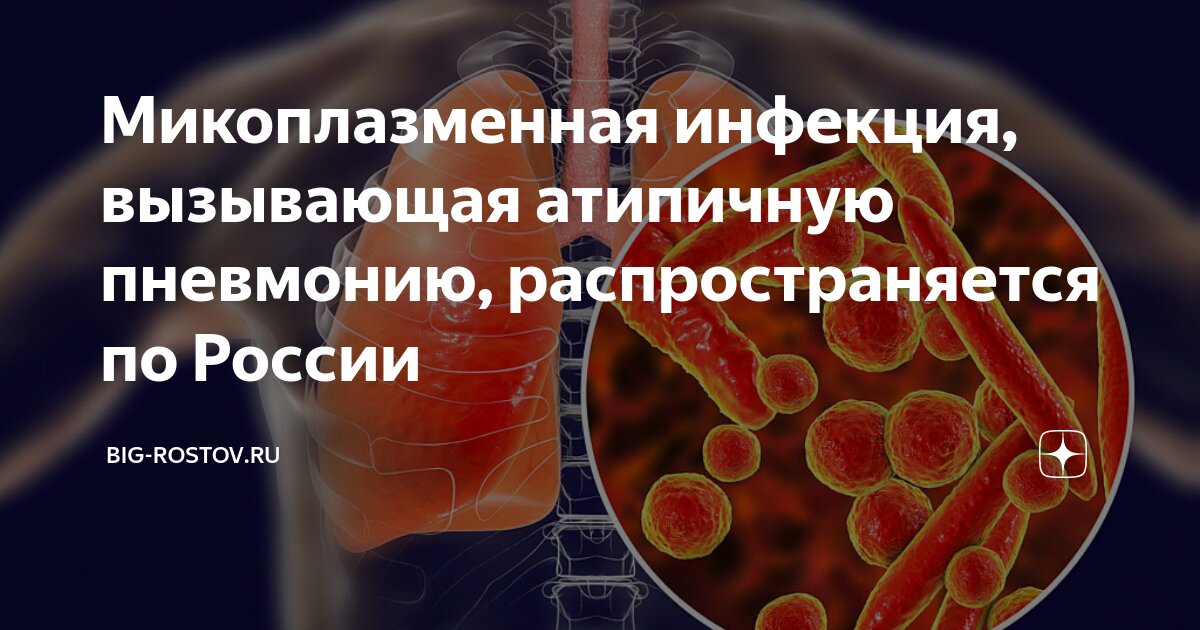 Микоплазменная инфекция рекомендации. Микоплазменная инфекция. Микоплазменная инфекция клиническая классификация. Микоплазменная инфекция картинки. Микоплазменная пневмония симптомы