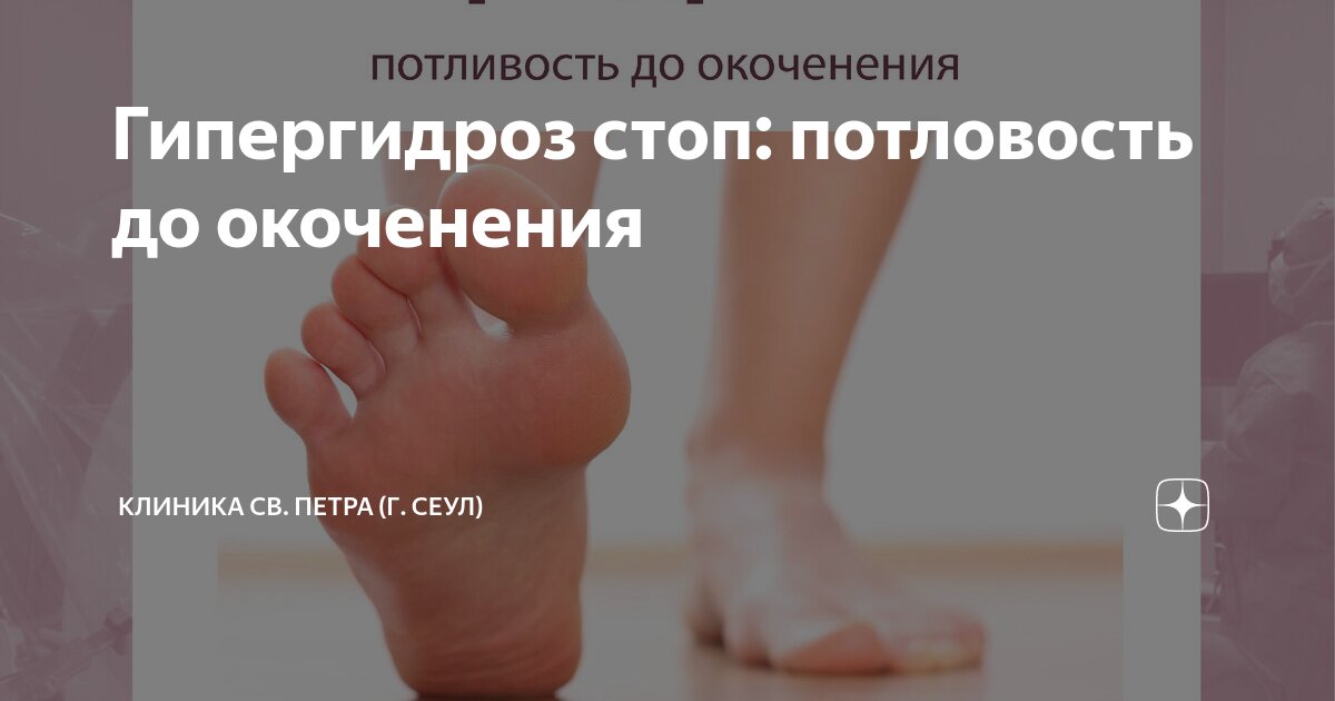 Гипергидроз стоп: потловость до окоченения | Клиника св. Петра (г. Сеул ...
