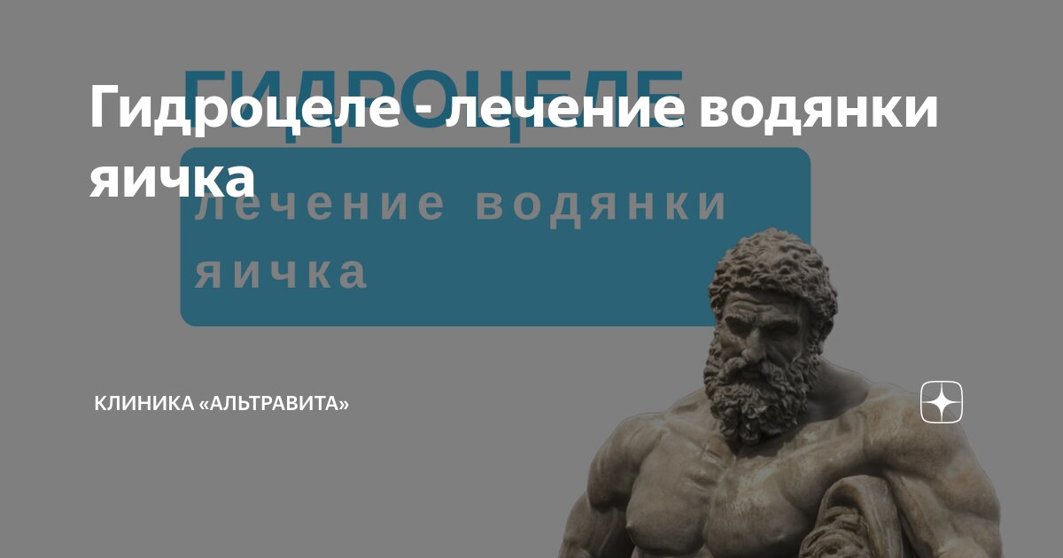 Гидроцеле - лечение водянки яичка | Клиника «АльтраВита» | Дзен