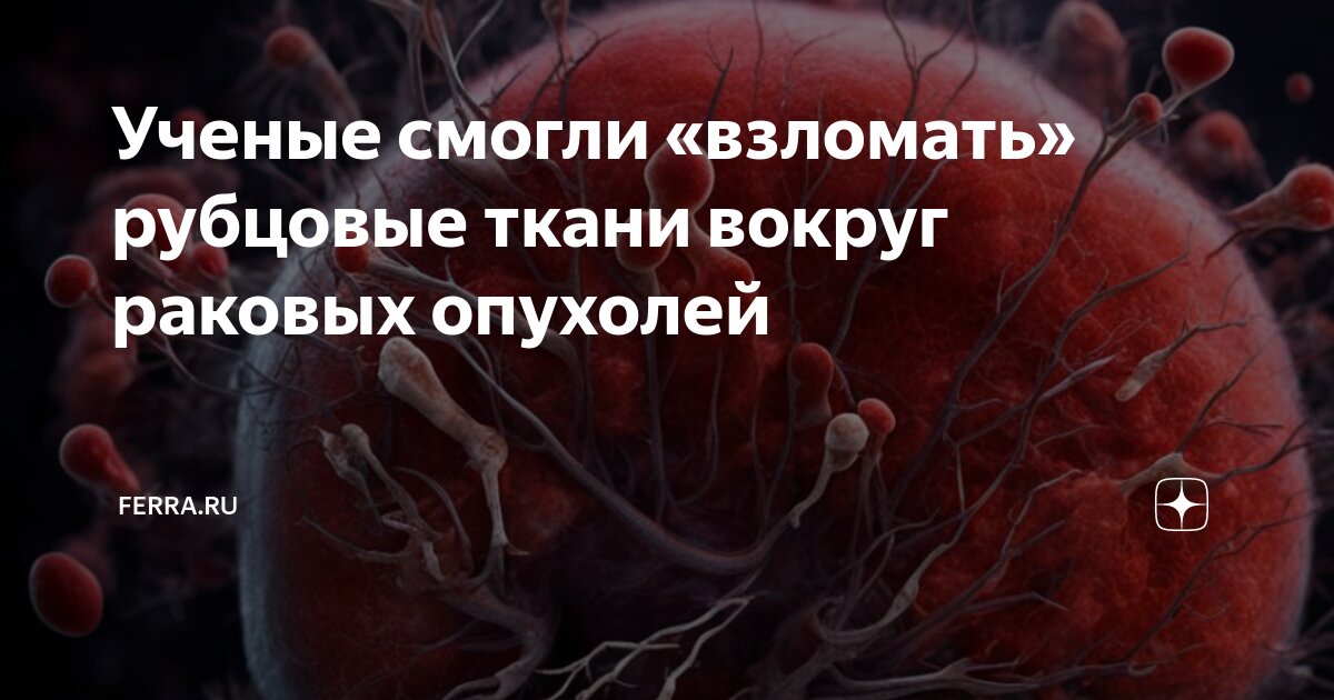Ученые смогли «взломать» рубцовые ткани вокруг раковых опухолей | Ferra ...