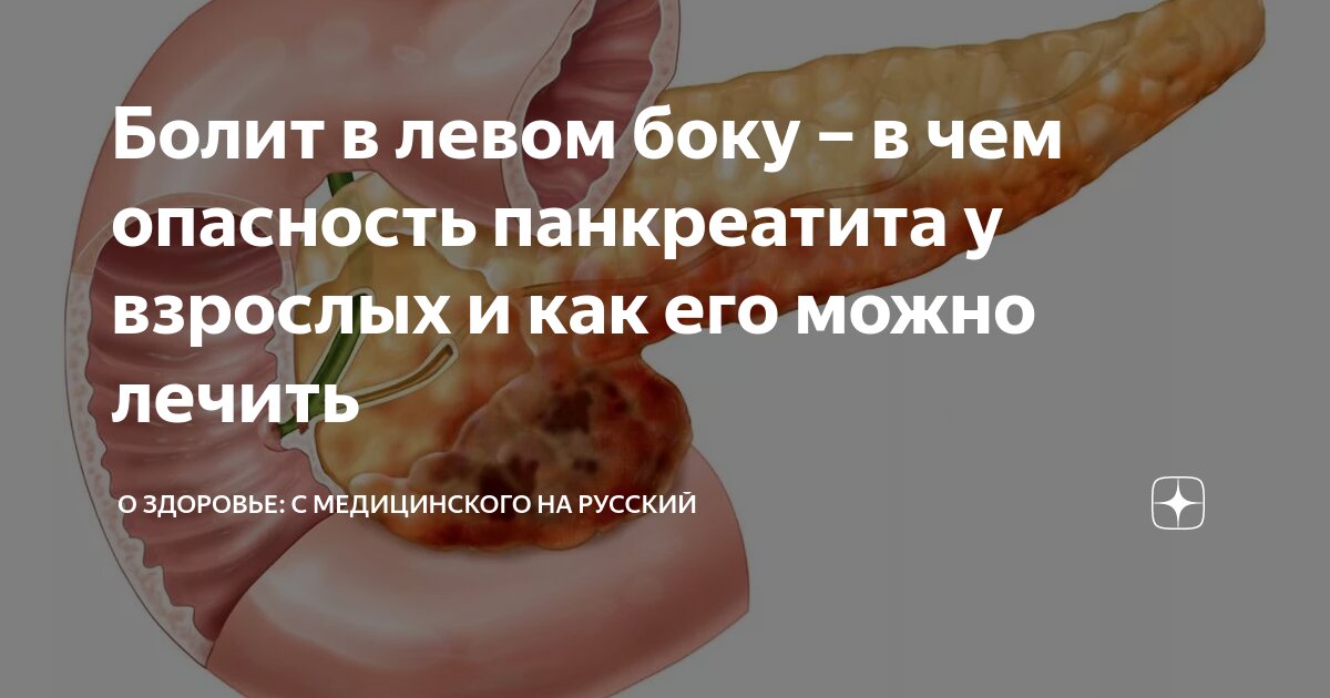 Болит в левом боку – в чем опасность панкреатита у взрослых и как его ...