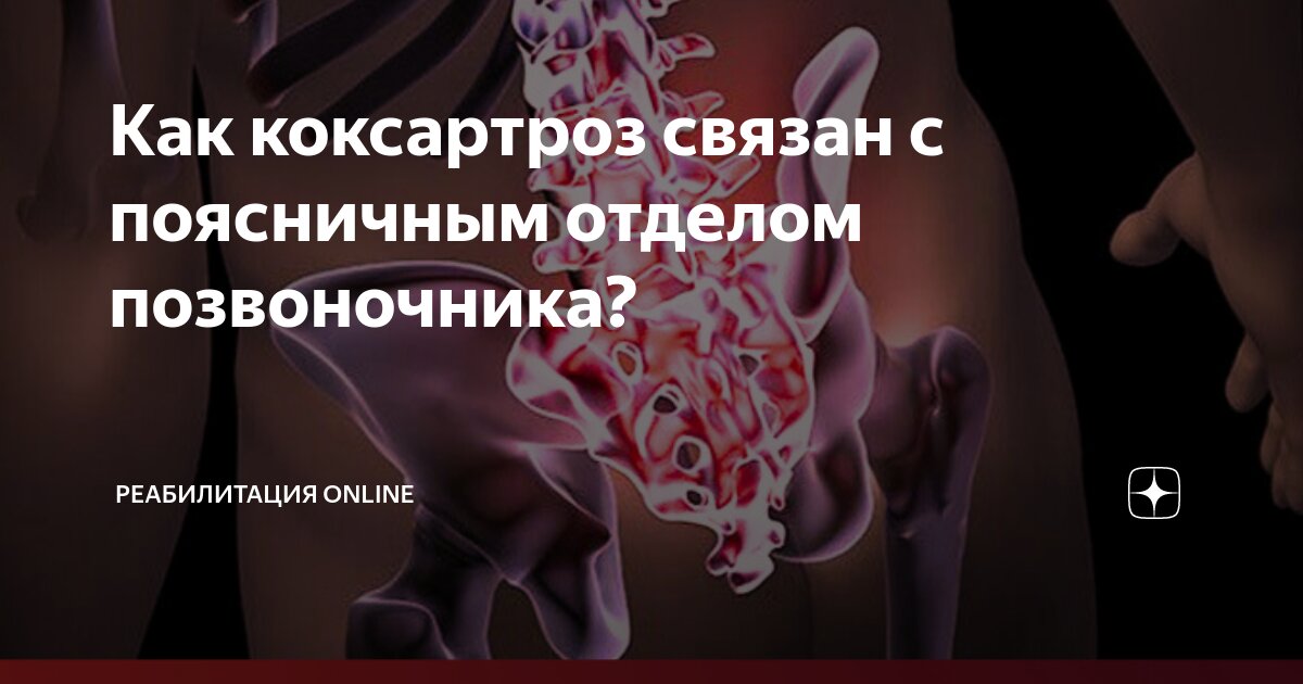 Коксартроз работа с отягощением. Коксартроз - Лечение в Москве | Clinic Расскажем о Тазобедренный сустав 3 степени что делать Как коксартроз связан с поясничным отделом позвоночника? | Реабилитация.