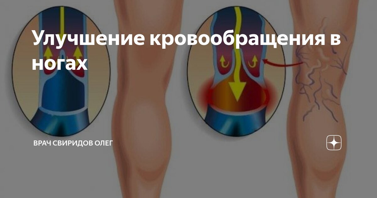 Улучшение кровообращения в ногах | Врач Свиридов Олег | Дзен