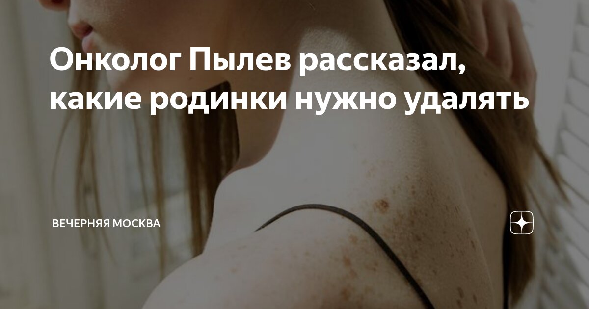 Онколог Пылев рассказал, какие родинки нужно удалять | Вечерняя Москва ...