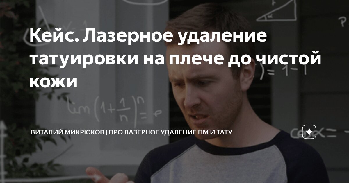 Кейс. Лазерное удаление татуировки на плече до чистой кожи | Виталий ...
