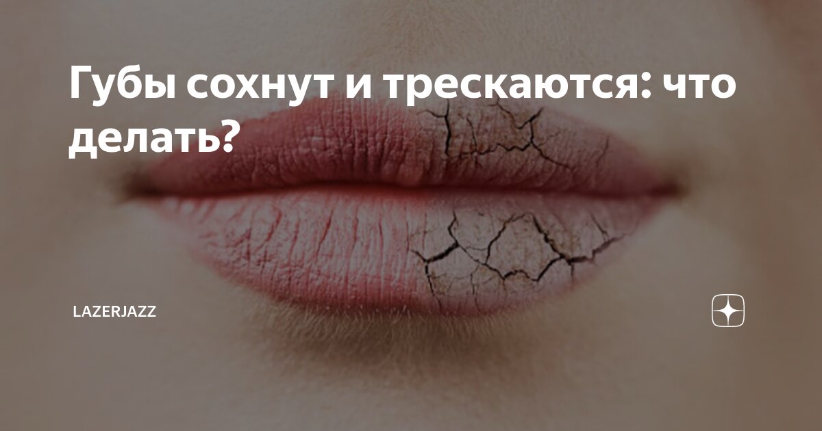 губы сухие и трескаются что делать