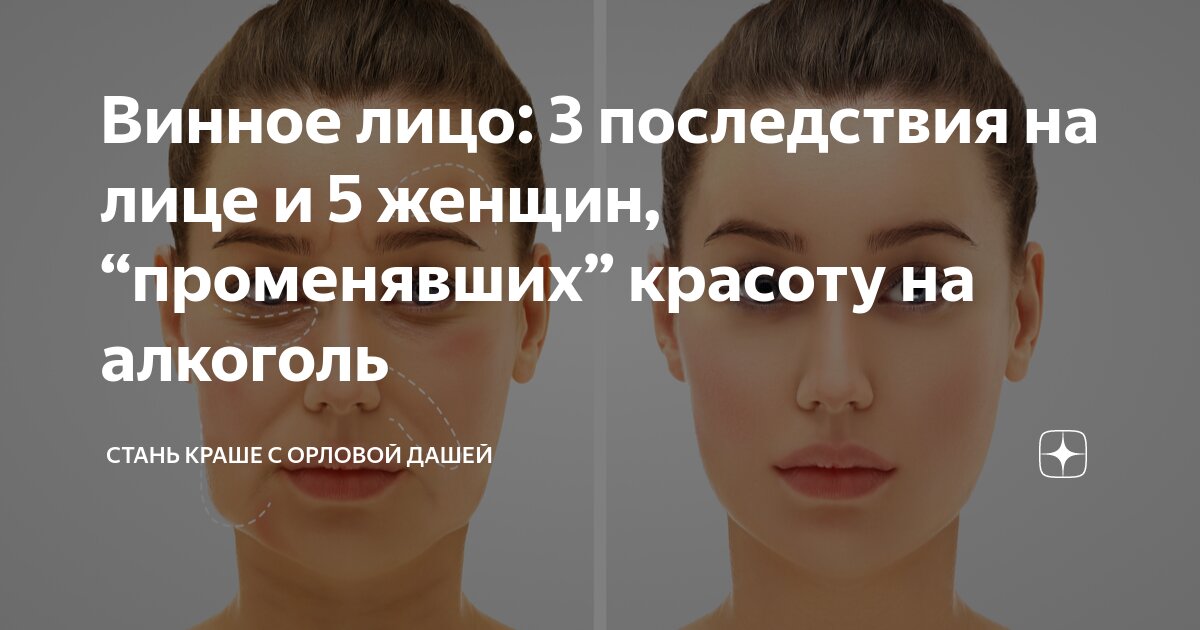 что я делала с лицом