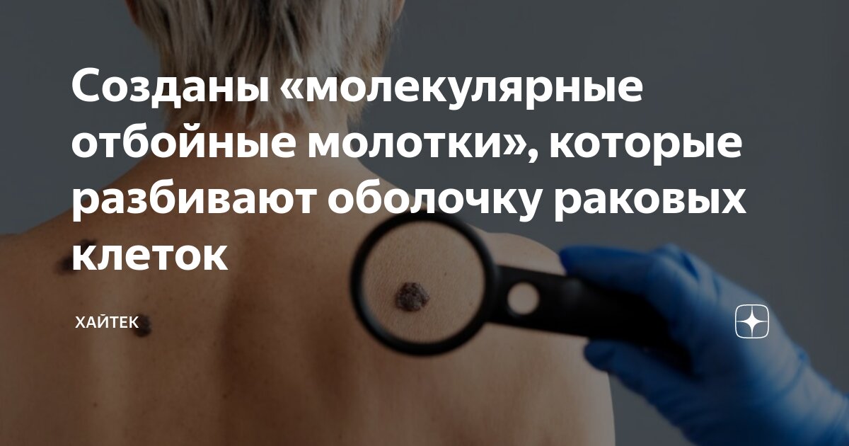 Существующие методы лечения рака