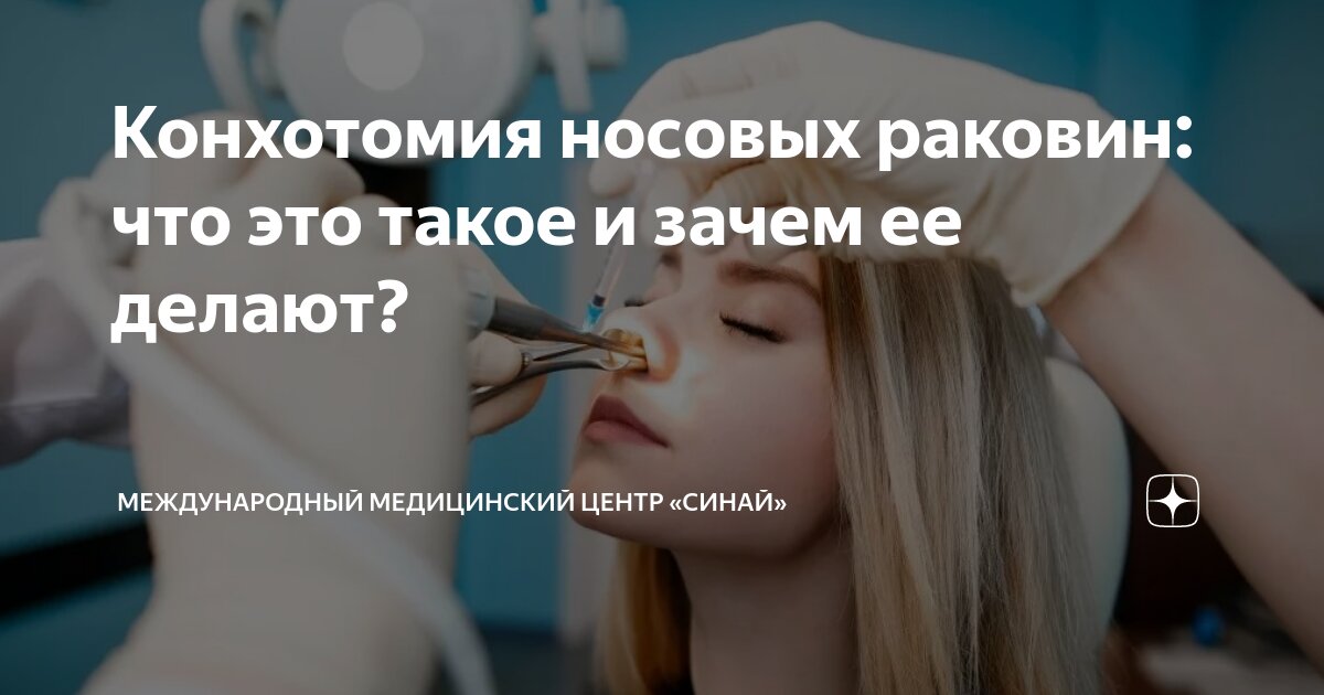 Конхотомия носовых раковин: что это такое и зачем ее делают ...