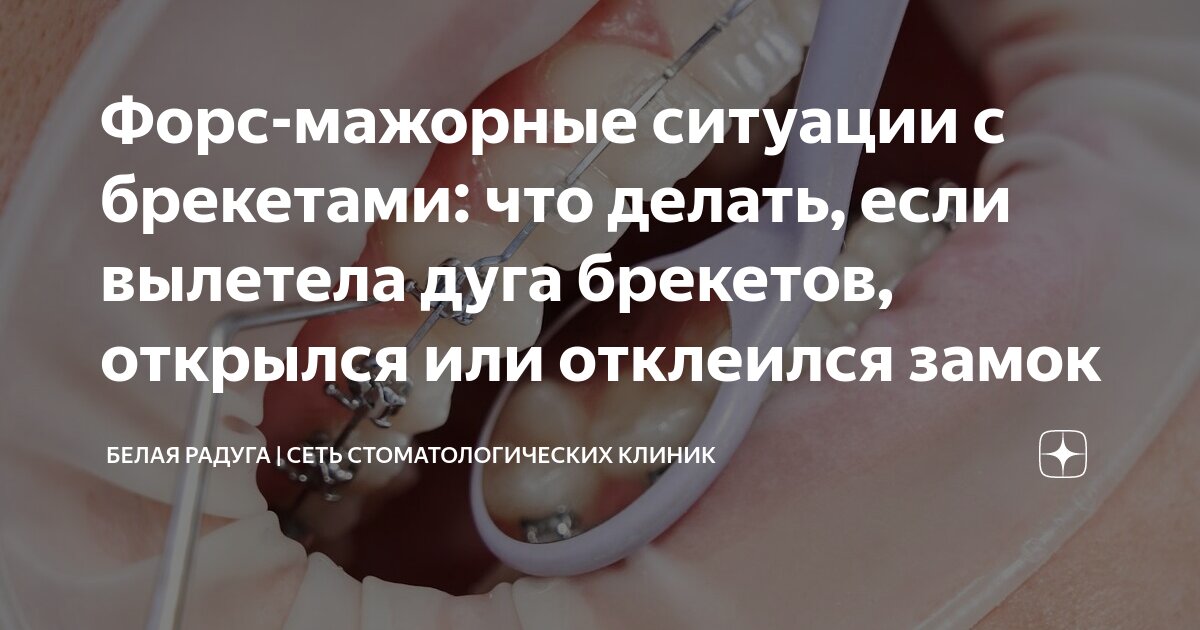 что делать если дуга от брекетов царапает щеку