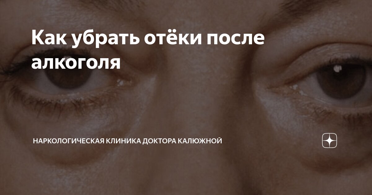 Как быстро снять отечность после запоя