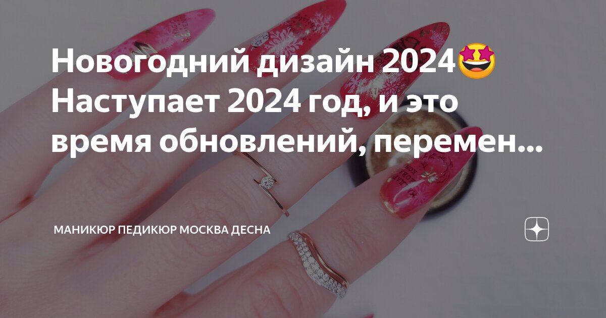 Рандомные варианты модного педикюра на Новый 2024 год (ФОТО)