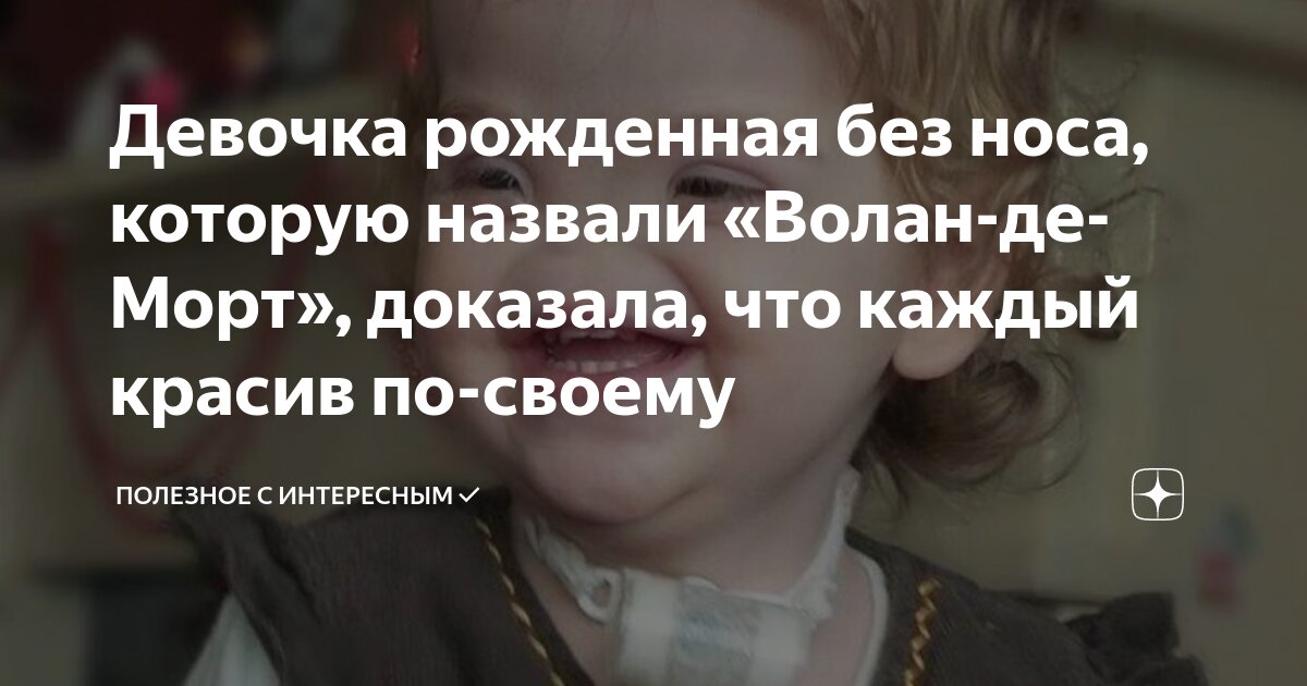 Важно понимать, что подобная операция далеко не простая и требует огромных усилий со стороны медицинского персонала. Операции по реконструкции лица стали возможными благодаря передовым технологиям искусственного интеллекта. Именно эти технологии позволили вернуть улыбку на лицо этой девочки и дать ей возможность чувствовать себя такой же обычной и счастливой, как и ее сверстники.