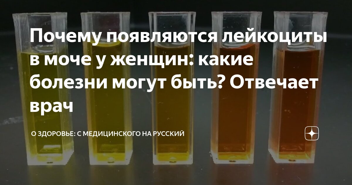 Почему появляются лейкоциты в моче у женщин: какие болезни могут быть ...