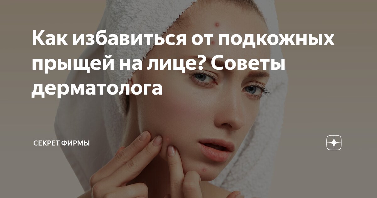 Как избавиться от прыщей? 5 советов дерматолога