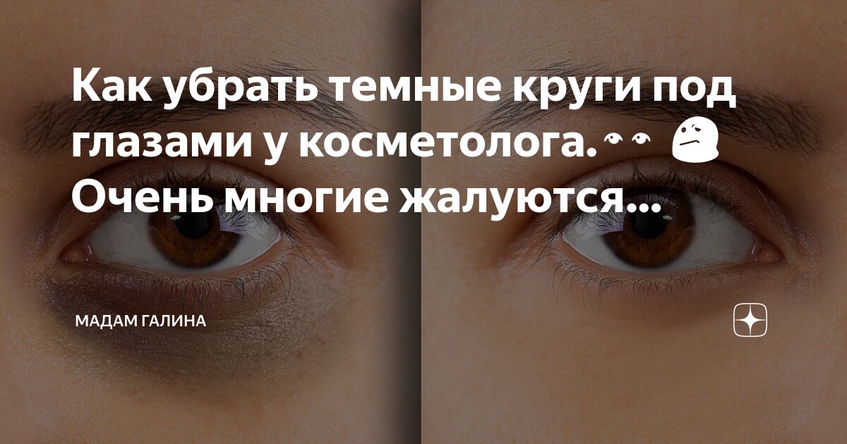 Наличие темный Наличие темный