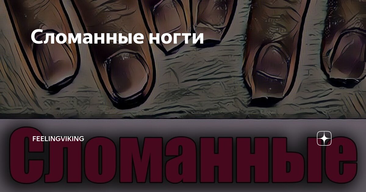К чему снится поломанные ногти на руках