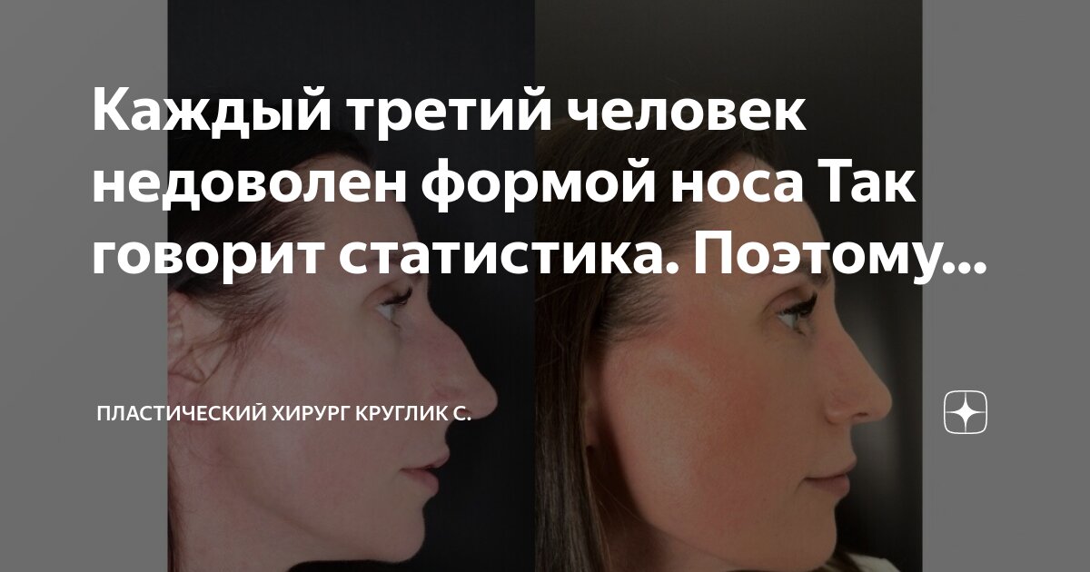 Теплый нос у человека. Теплый нос у человека. Женский подбородок. Тео ринопластика. Ринопластика опущение колумеллы.