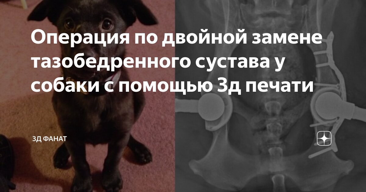 Чебоксары операция тазобедренного сустава. Чебоксары операция тазобедренного сустава