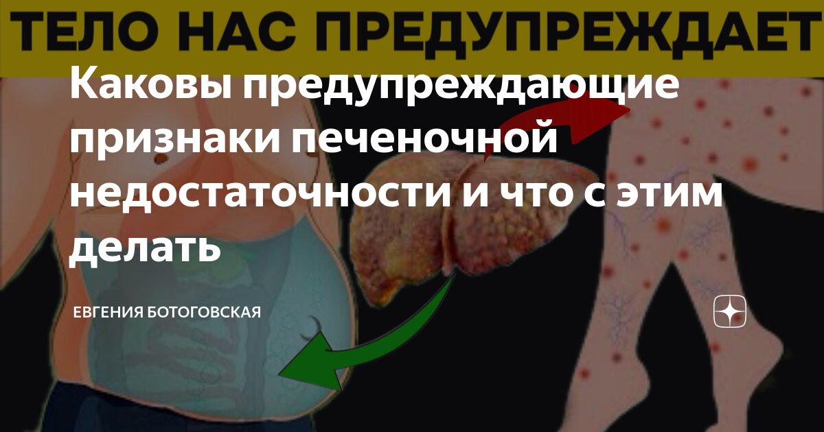 Острая печеночная недостаточность. Что такое Острая печеночная недостаточность?