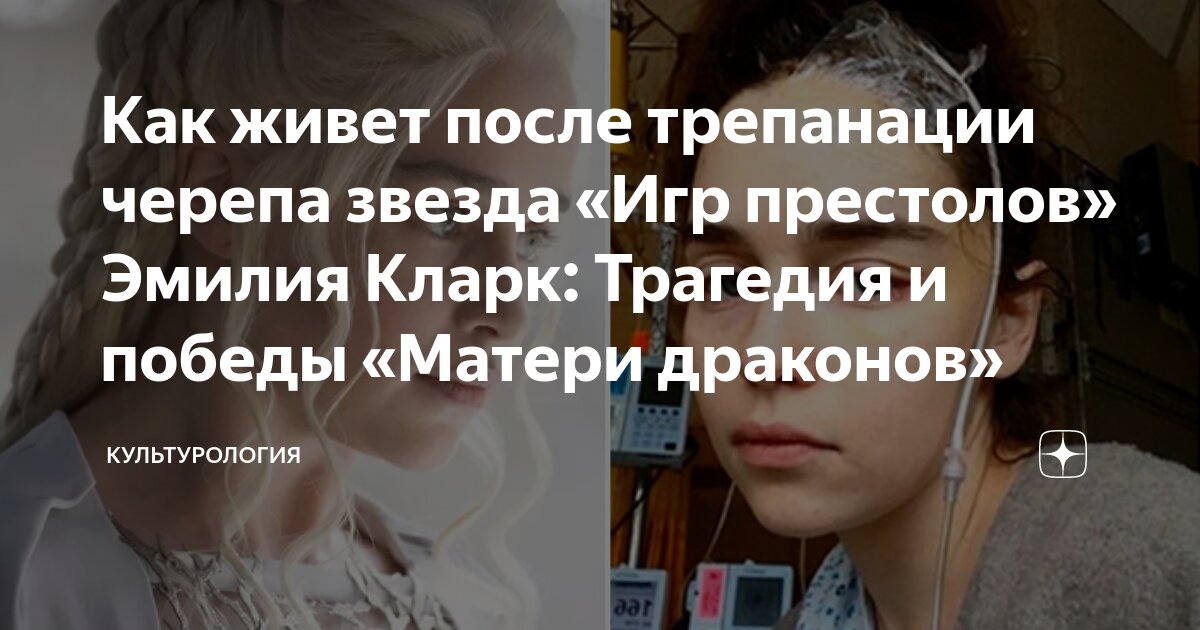Как живет после трепанации черепа звезда «Игр престолов» Эмилия Кларк ...