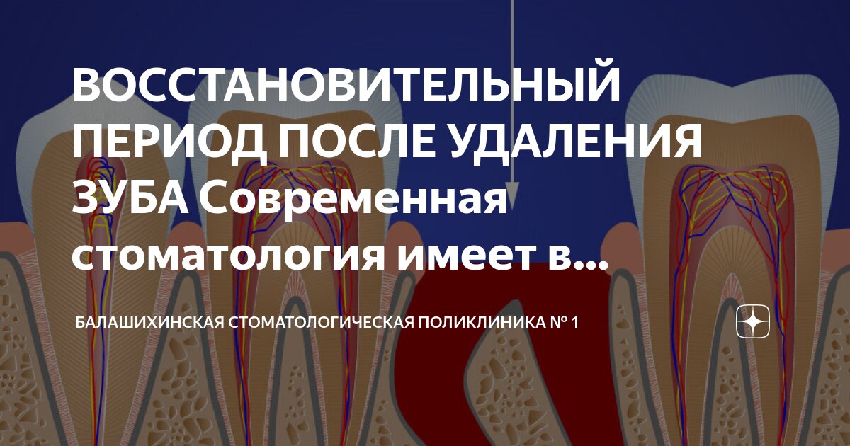 рекомендации после удаления зубов мудрости. рекомендации после удаления зуба. молоко после удаления зуба. рекомендации после вырванного зуба. лунка после удалённого зуба.