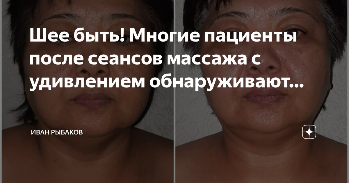 удивленная девушка. удивленные лица людей. эмоция сильного удивления. портрет человека удивление. удивленные глаза.