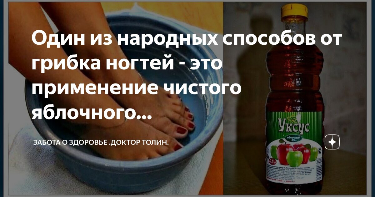 Лечение грибка ногтей на ногах яблочным уксусом