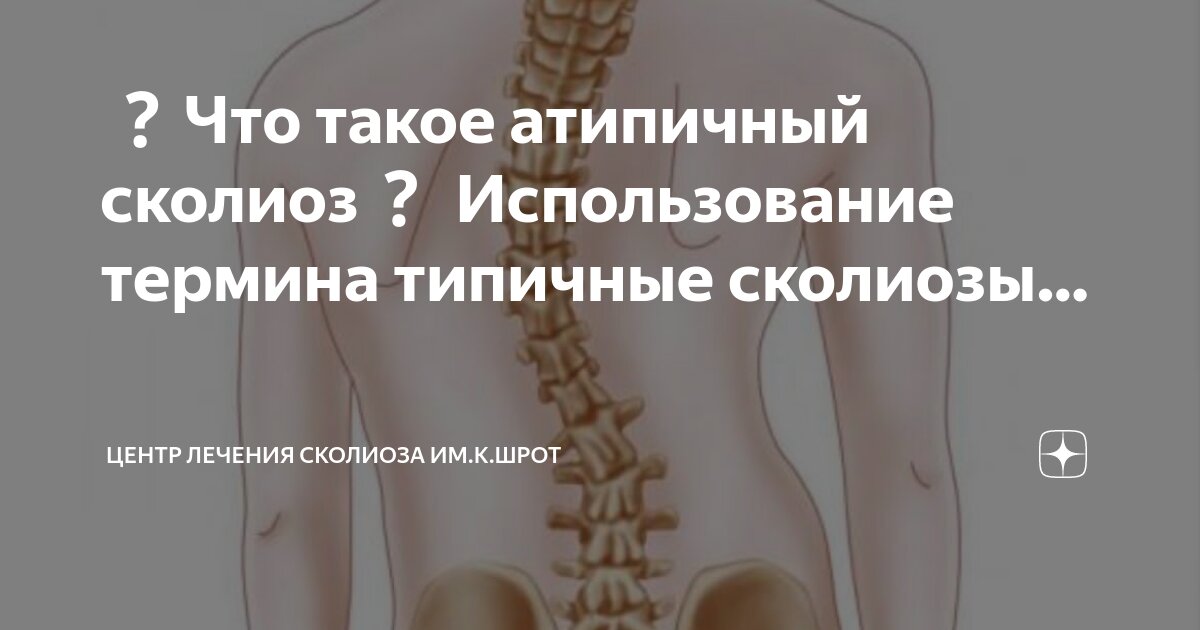 Как лечить сколиоз 1 степени у подростков. Как лечить сколиоз 1 степени у подростков