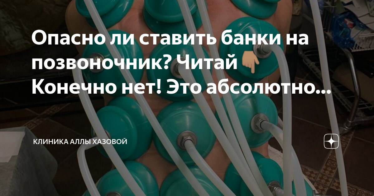 банки ставят на спину при пневмонии