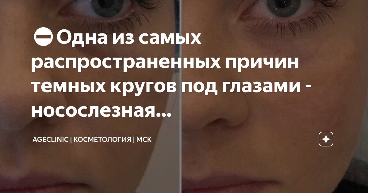 пилинг у косметолога. косметология посты. косметология посты. косметолог эстетист. косметология визуал.